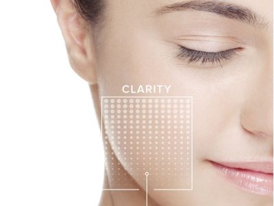 Facial_Peels Vita-Clear Skin